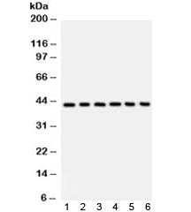 Western blot testing of 1) human placenta, 2) Jurkat, 3) CEM, 4) HL60, 5) rat spleen and 6) mouse sp
