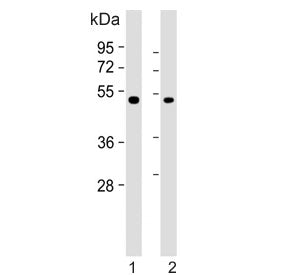 Inhibin beta B chain Antibody / INHBB
