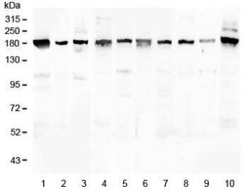 PCDH15 Antibody / Protocadherin 15