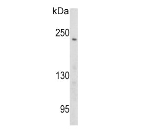 PCM1 Antibody / Pericentriolar material 1 protein