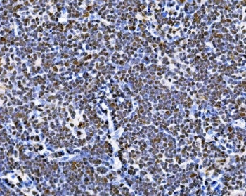 IHC staining of FFPE rat thymus tissue with BUB1 antibody. HIER: boil tissue sections in pH8 EDTA fo
