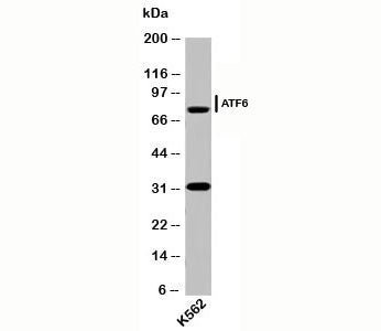 Western blot testing of human samples with ATF6 antibody (AF6229) at 2ug/ml. Predicted molecular weight: 75~90kDa.