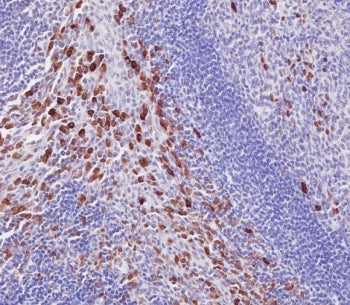 IHC staining of FFPE human tonsil with IRAK3 antibody. HIER: boil tissue sections in pH6, 10mM citra