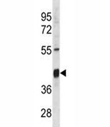 Txnip Antibody