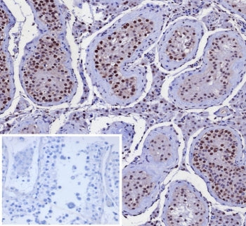 IHC staining of FFPE human testis tissue with Kinesin Family Member 2C antibody (clone KIF2C/4707) a