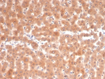 Fibroblast Activation Protein Alpha Antibody / FAP