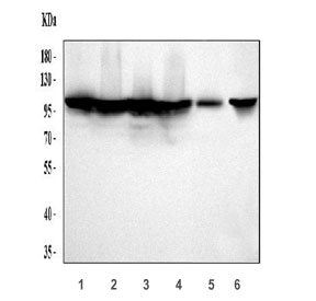 Mineralocorticoid Receptor Antibody / MR