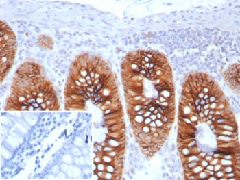 IHC staining of FFPE human colon tissue with Cadherin 17 antibody (clone CDH17/8513R). Inset: PBS us