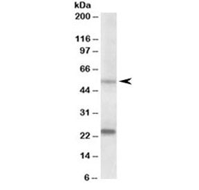 Western blot testing of human prostate lysate with MMP3 antibody at 0.2ug/ml. Molecular weight: the 