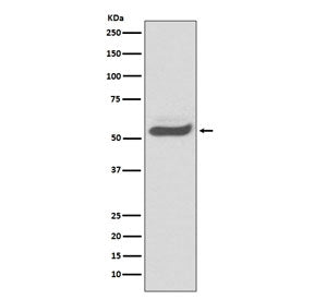 Alpha 1 Antitrypsin Antibody / AAT / SERPINA1