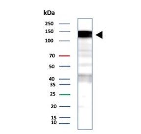 Western blot testing of human A431 cell lysate with recombinant Epidermal growth factor receptor ant