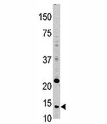 Thioredoxin Antibody (TRX)