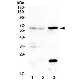 Western blot testing of mouse 1) brain, 2) liver and 3) kidney lysate with Il23r antibody at 0.5ug/m