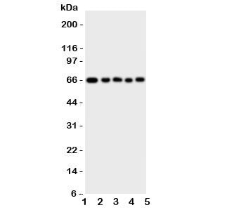 Western blot testing of MBD4 antbody; Lane 1: rat brain; 2: (r) kidney; 3: human A549; 4: (h) HeLa; 
