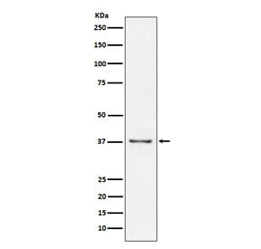CD23 Antibody