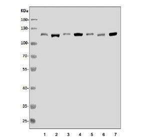 XRN2 Antibody
