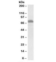 Western blot testing of rat thymus lysate with ITK antibody at 0.3ug/ml. Predicted molecular weight: