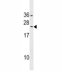 RAB5B Antibody