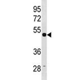 TUBG1 Antibody (Tubulin gamma 1)