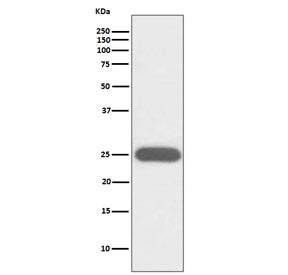CSF3 Antibody / Granulocyte-Colony Stimulating Factor