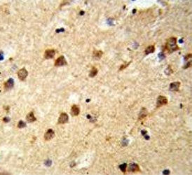 Ataxin 3 Antibody / ATXN3