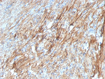 IHC staining of FFPE human lung with Fibronectin antibody (clone FN1/3029). HIER: boil tissue sectio