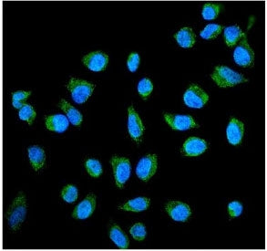 Alkaline phosphatase Antibody (placental)