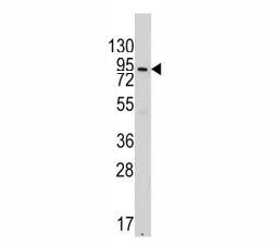 VE Cadherin Antibody (CDH5)