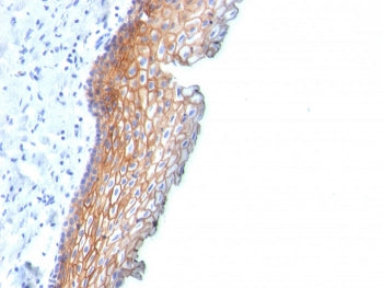 Desmoglein 3 Antibody / DSG3
