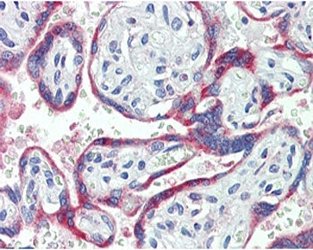 NOX2 Antibody