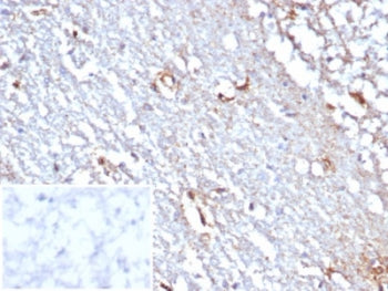 STAT6 Antibody