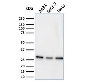 Western blot testing of human samples with Myofibroblast antibody (clone PR 2D3).