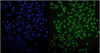 UHRF1 Antibody