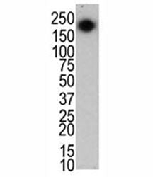 PARK8 Antibody (LRRK2)