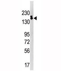 SETDB1 Antibody