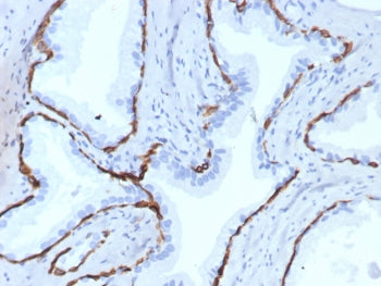 Cytokeratin 14 Antibody / CK14 / KRT14