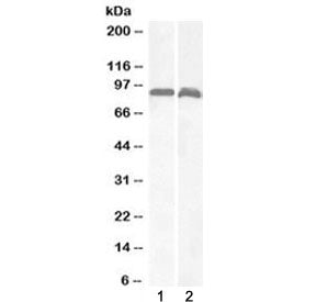 Western blot testing of 1) human brain (cerebellum) and 2) rat brain lysate with VPS35 antibody at 1