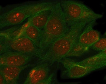 Immunofluorescent staining of FFPE human HeLa cells with SMC5 antibody (red) and Beta Tubulin mAb (g