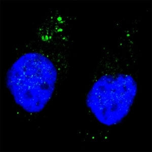 Phospho-ULK1 Antibody (pS556)