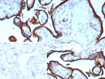 IHC staining of FFPE human placental tissue with recombinant Transferrin Receptor antibody (clone TF