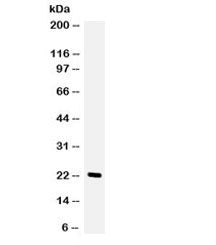 Granulocyte-Colony Stimulating Factor Antibody / CSF3