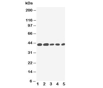 IL-2 Receptor Antibody (gamma subunit)
