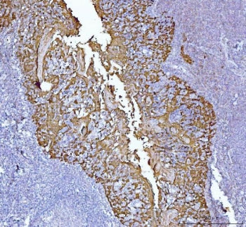 SERPINB5 Antibody / MASPIN