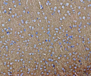 IHC staining of FFPE mouse brain tissue with SEPT3 antibody. HIER: boil tissue sections in pH8 EDTA 
