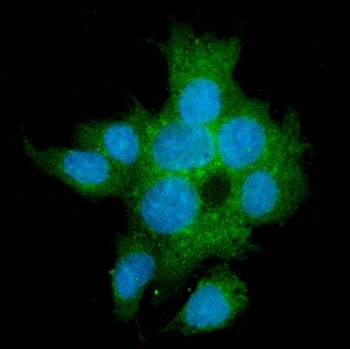 TGFBR2 Antibody / TGF beta Receptor II