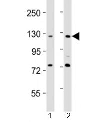 Western blot testing of AATK antibody at 1:2000 dilution. Lane 1: HeLa lysate; 2: NIH3T3 lysate; Pre