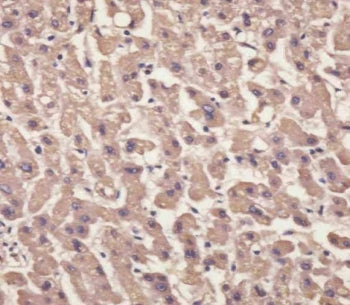 Transthyretin Antibody / TTR / Prealbumin