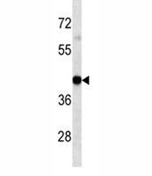 HLA-A Antibody, 0.4ml
