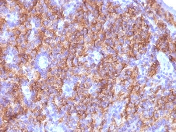 IHC: Formalin-fixed, paraffin-embedded parathyroid stained with Chromogranin A antibody (CGA/413 + C