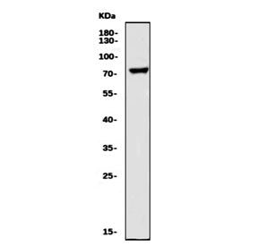 Western blot testing of human HeLa cell lysate with LHCGR antibody. Expected molecular weight: 38-60